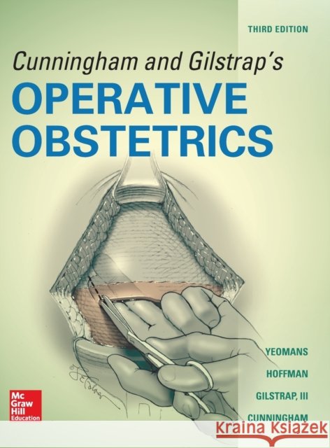 Cunningham and Gilstrap's Operative Obstetrics, Third Edition F. Cunningham Larry Gilstrap Edward Yeomans 9780071849067 McGraw-Hill Education / Medical - książka