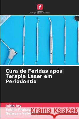 Cura de Feridas após Terapia Laser em Periodontia Joy, Jobin 9786205311943 Edicoes Nosso Conhecimento - książka