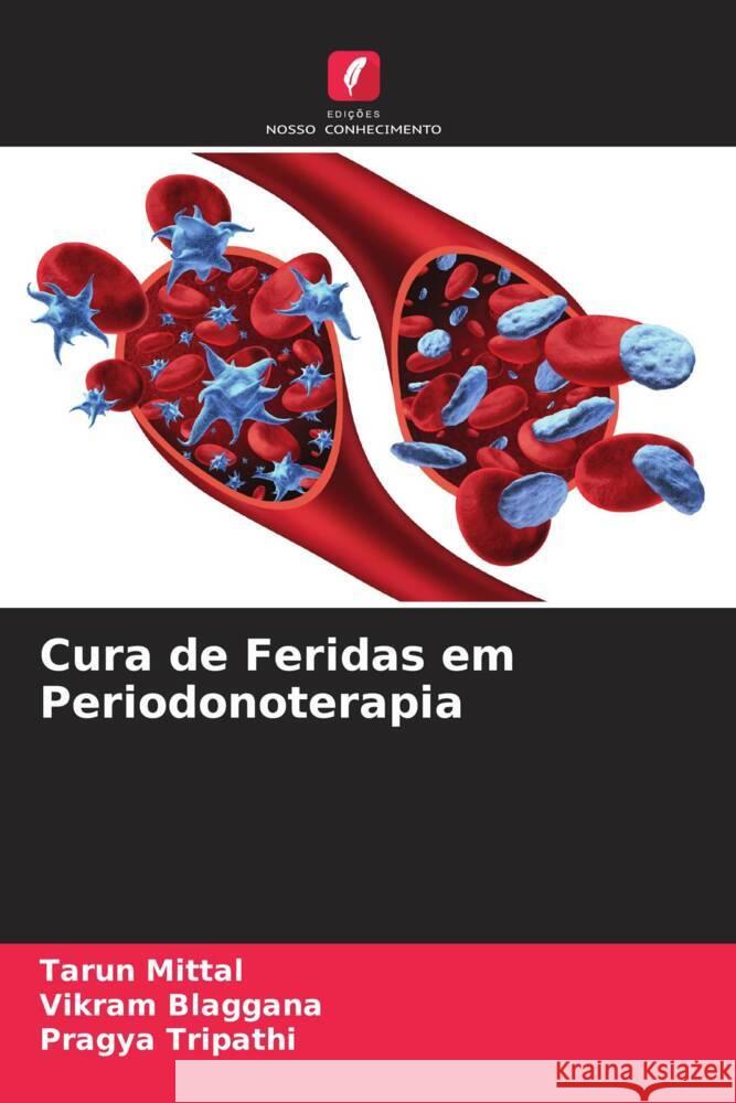 Cura de Feridas em Periodonoterapia Mittal, Tarun, Blaggana, Vikram, Tripathi, Pragya 9786205112717 Edições Nosso Conhecimento - książka