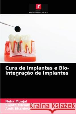 Cura de Implantes e Bio- Integração de Implantes Neha Munjal, Sujata Masamatti, Amit Bhardwaj 9786203318098 Edicoes Nosso Conhecimento - książka