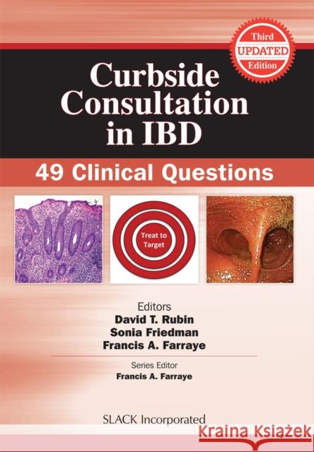 Curbside Consultation in Ibd: 49 Clinical Questions Rubin, David T. 9781630916503 Slack - książka