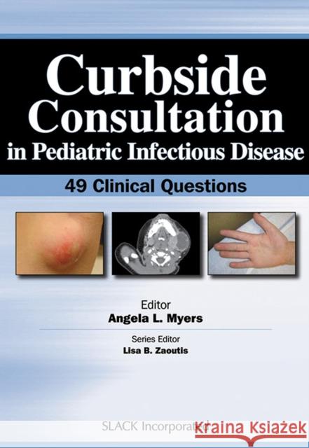 Curbside Consultation in Pediatric Infectious Disease: 49 Clinical Questions Myers, Angela L. 9781617110016 Slack - książka