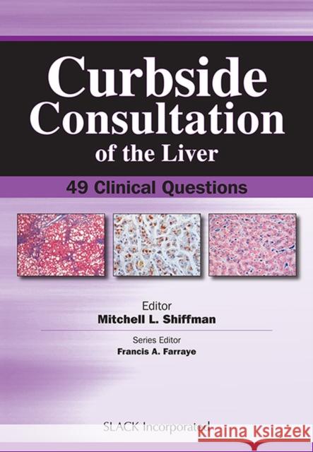 Curbside Consultation of the Liver: 49 Clinical Questions Shiffman, Mitchell 9781556428159 Slack - książka