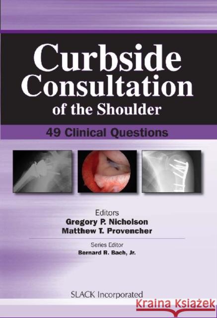 Curbside Consultation of the Shoulder: 49 Clinical Questions Nicholson, Gregory 9781556428272 Slack - książka