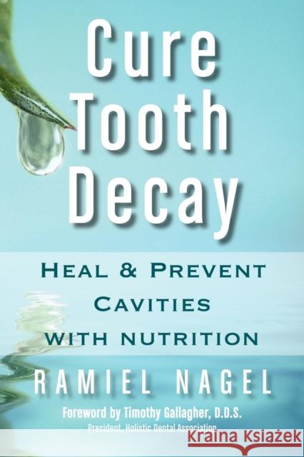 Cure Tooth Decay: Heal and Prevent Cavities with Nutrition Nagel, Ramiel 9780982021309 Golden Child Publishing - książka