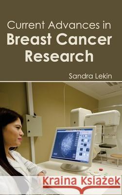 Current Advances in Breast Cancer Research Sandra Lekin 9781632410986 Hayle Medical - książka