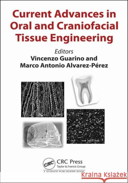 Current Advances in Oral and Craniofacial Tissue Engineering Vincenzo Guarino Marco Antonio Alverez-Perez 9781138390911 CRC Press - książka