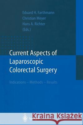 Current Aspects of Laparoscopic Colorectal Surgery: Indications - Methods - Results Farthmann, Eduard H. 9783642643811 Springer - książka