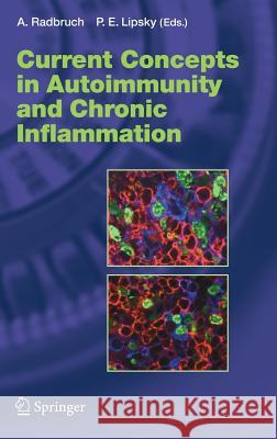 Current Concepts in Autoimmunity and Chronic Inflammation Andreas Radbruch, Peter E. Lipsky 9783540297130 Springer-Verlag Berlin and Heidelberg GmbH &  - książka