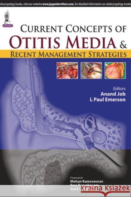 Current Concepts of Otitis Media and Recent Management Strategies Anand Job Paul L. Emerson  9789351524533 Jaypee Brothers Medical Publishers - książka