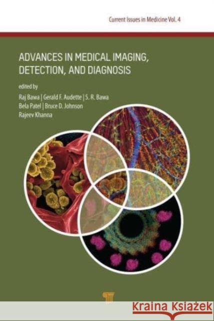 Current Issues in Medicine: Advances in Medical Imaging, Detection, and Diagnosis Raj Bawa Gerald F. Audette S. R. Bawa 9789814877466 Jenny Stanford Publishing - książka