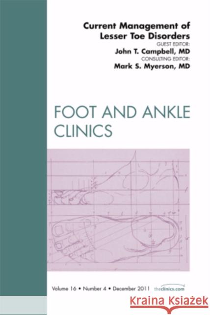 Current Management of Lesser Toe Disorders, an Issue of Foot and Ankle Clinics: Volume 16-4 Campbell, John T. 9781455704491 W.B. Saunders Company - książka