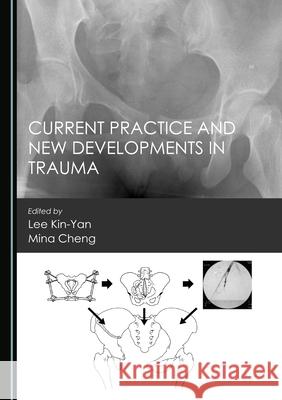 Current Practice and New Developments in Trauma Lee Kin-Yan Mina Cheng 9781527574199 Cambridge Scholars Publishing - książka