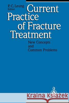 Current Practice of Fracture Treatment: New Concepts and Common Problems Leung, P. C. 9783642786051 Springer - książka