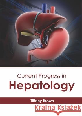 Current Progress in Hepatology Tiffany Brown 9781632416339 Hayle Medical - książka