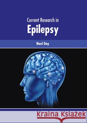 Current Research in Epilepsy Noel Day 9781639272860 American Medical Publishers - książka