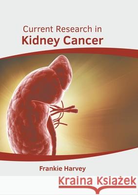 Current Research in Kidney Cancer Frankie Harvey 9781639891399 States Academic Press - książka