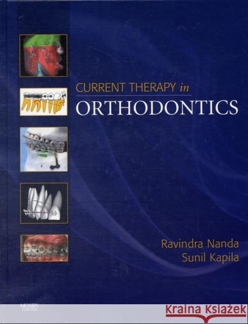Current Therapy in Orthodontics Ravindra Nanda 9780323054607 MOSBY - książka