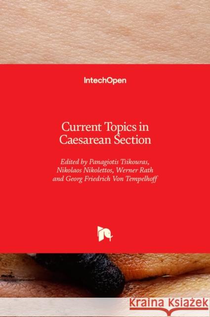 Current Topics in Caesarean Section Panagiotis Tsikouras Nikolaos Nikolettos Werner Rath 9781839691782 Intechopen - książka
