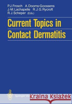 Current Topics in Contact Dermatitis Peter J. Frosch A. Dooms-Goossens J. -M LaChapelle 9783642743016 Springer - książka