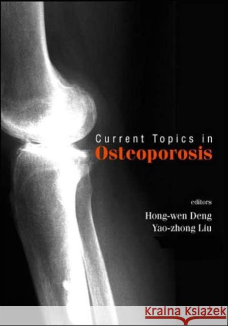 Current Topics in Osteoporosis Deng, Hong-Wen 9789812561534 World Scientific Publishing Company - książka