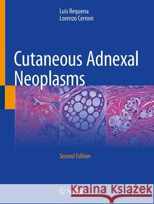 Cutaneous Adnexal Neoplasms Luis Requena Lorenzo Cerroni 9783032156631 Springer - książka