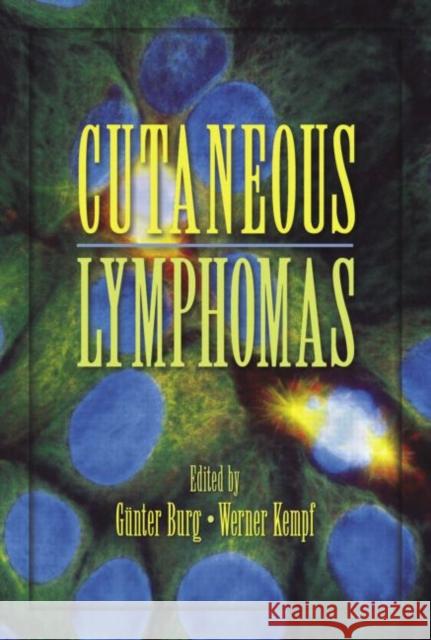 Cutaneous Lymphomas Burg Kempf                               Burg Burg Gunter Burg 9780824729974 Informa Healthcare - książka