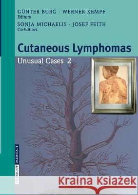 Cutaneous Lymphomas: Unusual Cases 2 Burg, G. 9783798599994 Steinkopff-Verlag Darmstadt - książka