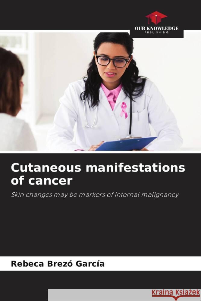 Cutaneous manifestations of cancer Brezó García, Rebeca 9786204937564 Our Knowledge Publishing - książka