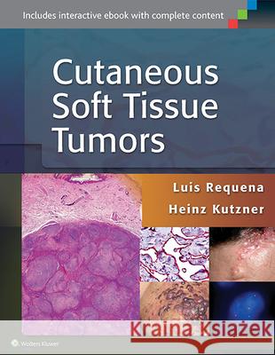 Cutaneous Soft Tissue Tumors Luis Requena Luis Requena Heinz Kutzner 9781451192766 Lippincott Williams & Wilkins - książka