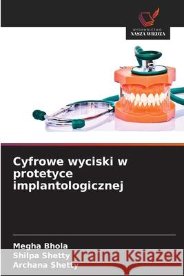 Cyfrowe wyciski w protetyce implantologicznej Bhola, Megha, Shetty, Shilpa, Shetty, Archana 9783330825635 Wydawnictwo Nasza Wiedza - książka