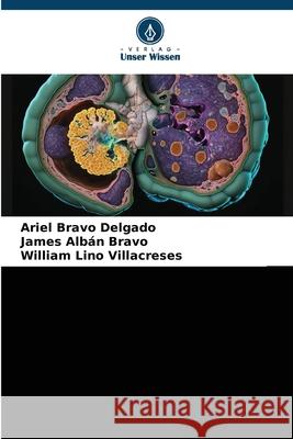Cystatin C bei Nierenfunktionsstörung Bravo Delgado, Ariel, Albán Bravo, James, Lino Villacreses, William 9786209125867 Verlag Unser Wissen - książka