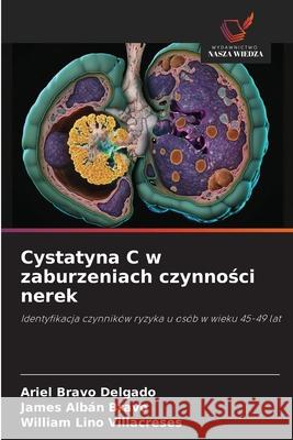 Cystatyna C w zaburzeniach czynnosci nerek Bravo Delgado, Ariel, Albán Bravo, James, Lino Villacreses, William 9786209133541 Wydawnictwo Nasza Wiedza - książka