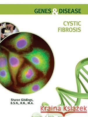 Cystic Fibrosis Sharon Giddings 9780791096949 Chelsea House Publishers - książka