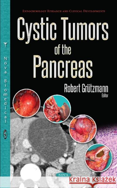 Cystic Tumors of the Pancreas Robert Grützmann 9781536125238 Nova Science Publishers Inc - książka