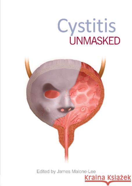 Cystitis Unmasked James Malone-Lee, MD FRCP   9781910079638 TFM Publishing Ltd - książka