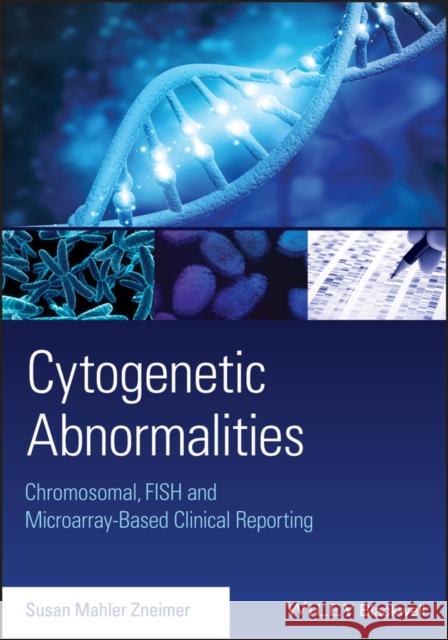 Cytogenetic Abnormalities: Chromosomal, Fish, and Microarray-Based Clinical Reporting and Interpretation of Result Zneimer, Susan Mahler 9781118912492 Wiley-Blackwell - książka
