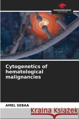 Cytogenetics of hematological malignancies SEBAA, Amel 9786208903848 Our Knowledge Publishing - książka