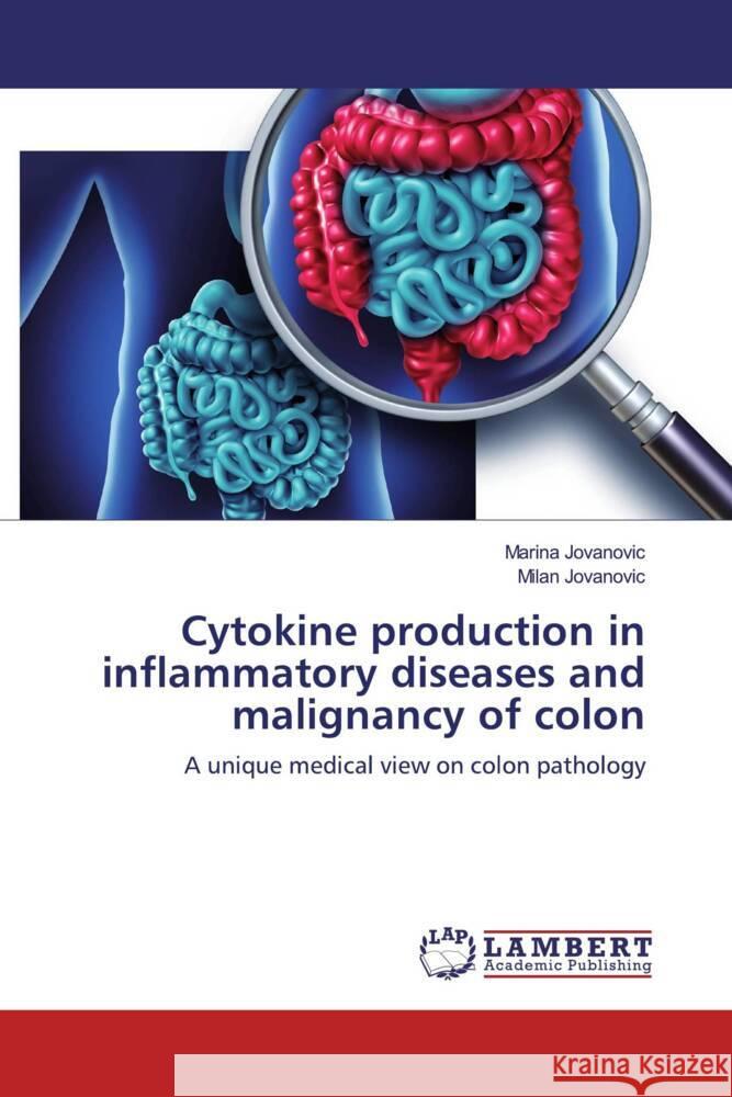 Cytokine production in inflammatory diseases and malignancy of colon Jovanovic, Marina, Jovanovic, Milan 9786200081483 LAP Lambert Academic Publishing - książka