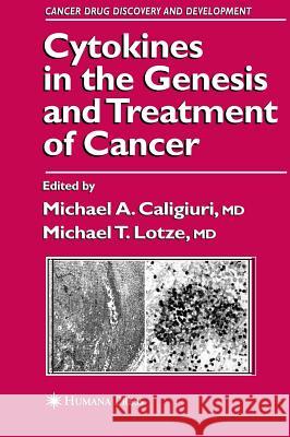 Cytokines in the Genesis and Treatment of Cancer Michael A. Caligiuri Michael T. Lotze 9780896038202 Humana Press - książka