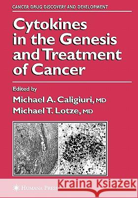 Cytokines in the Genesis and Treatment of Cancer Michael A. Caligiuri Michael T. Lotze 9781617372032 Springer - książka