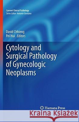 Cytology and Surgical Pathology of Gynecologic Neoplasms David Chhieng Pei Hui 9781607611639 Not Avail - książka