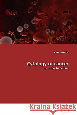 Cytology of cancer Kafil Akhtar 9783639294187 VDM Verlag - książka