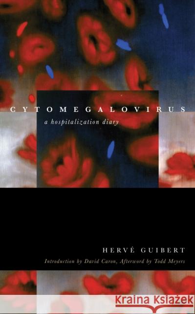 Cytomegalovirus: A Hospitalization Diary Herve Guibert Todd Meyers Clara Orban 9780823268566 Fordham University Press - książka