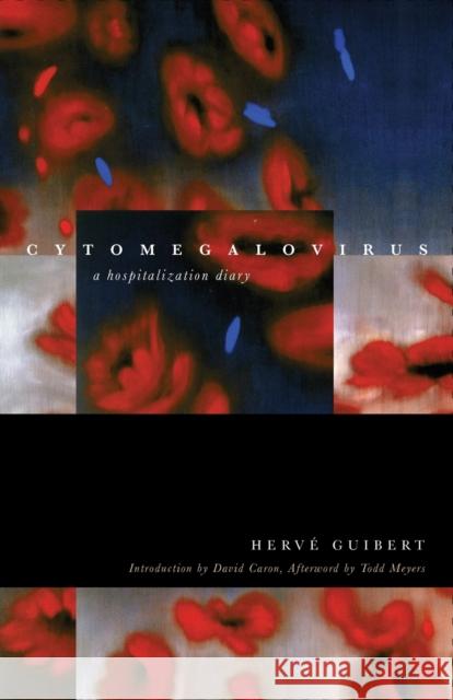 Cytomegalovirus: A Hospitalization Diary Herve Guibert Todd Meyers Clara Orban 9780823268573 Fordham University Press - książka