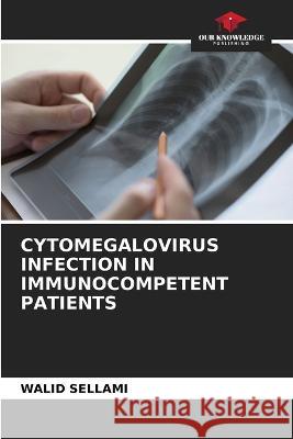 Cytomegalovirus Infection in Immunocompetent Patients Walid Sellami 9786205260647 Our Knowledge Publishing - książka