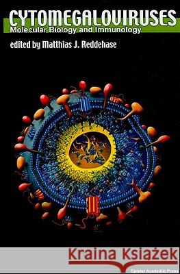 Cytomegaloviruses: Molecular Biology and Immunology Matthias Reddehase 9781904455028 Caister Academic Press - książka