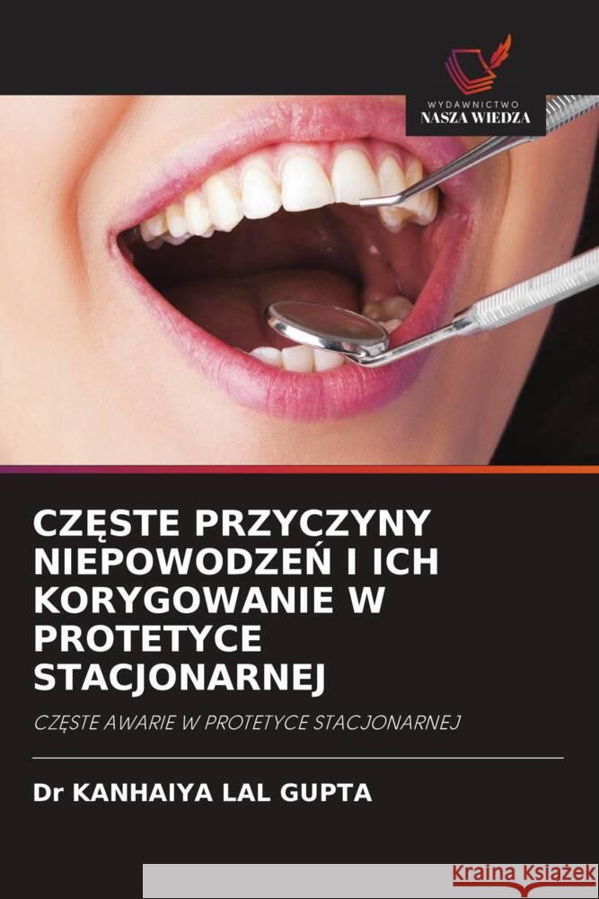 CZ STE PRZYCZYNY NIEPOWODZEN I ICH KORYGOWANIE W PROTETYCE STACJONARNEJ LAL GUPTA, Dr KANHAIYA 9786202870610 Wydawnictwo Nasza Wiedza - książka