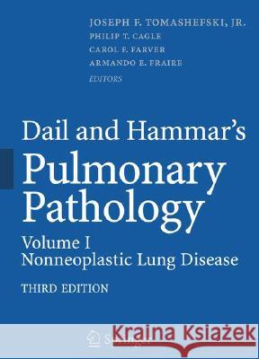 Dail and Hammar's Pulmonary Pathology: Volume I: Nonneoplastic Lung Disease Tomashefski, Joseph F. 9780387983950 Not Avail - książka