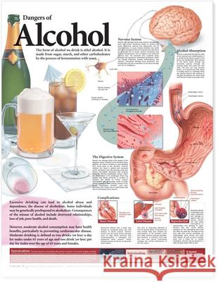 Dangers of Alcohol Anatomical Chart  Anatomical Chart Company 9780781782395  - książka